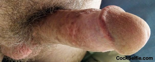 Big Circumsized Cock Wanting To Go Into A Hole... - Cock Selfie